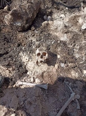 Xocalı rayonunun Fərrux kəndində insan skeletləri aşkarlanıb FOTO